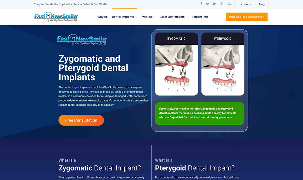 FastNewSmile® - Implants Page